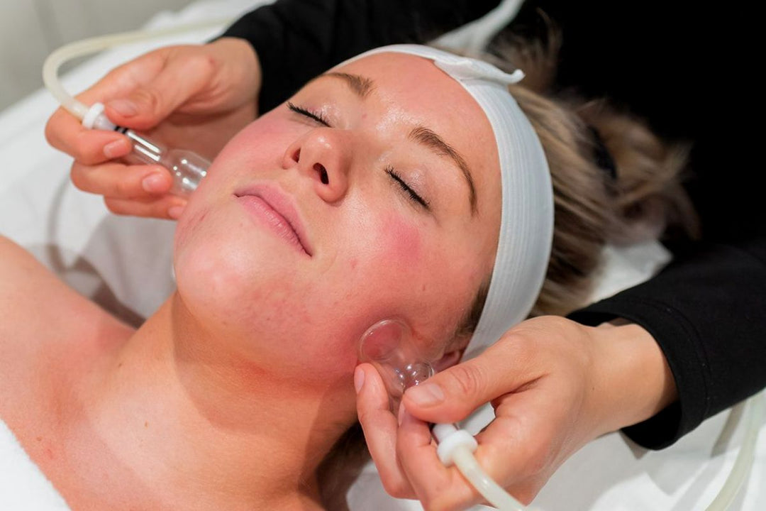 Person receiving a facial treatment with glass suction tools on the cheeks while lying down with eyes closed.
